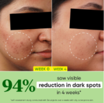 Dot & Key Cica + 10% Niacinamide Spot Reduction Face Serum 30ml - Image 3